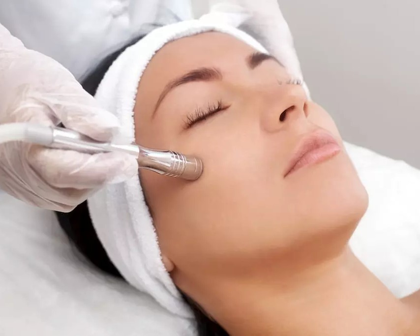 Microdermabrasion